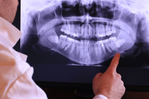 Best Emergency Denture Repair in Warsaw, MO